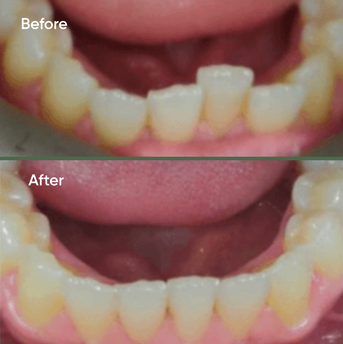 Before and after dental treatment 3